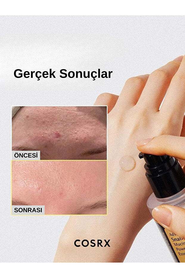 COSRX Advanced Snail 96 Mucin Power Essence 100 ml – Salyangoz Özlü Nemlendirici Esans